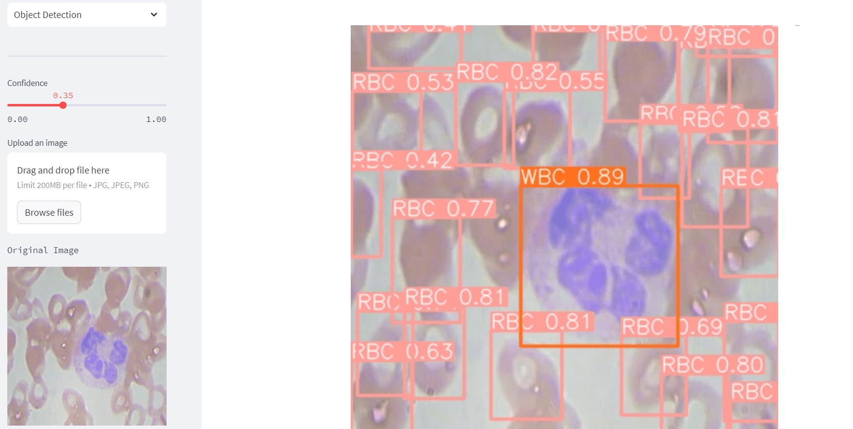 YOLOv8 Medical Imaging screenshot